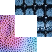AI cornerstone, pink coral brain