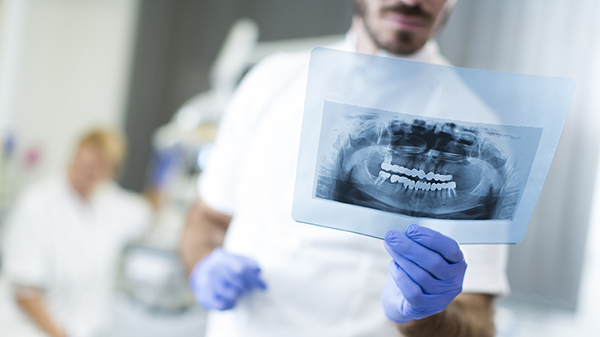 Et røntgenbilde hos tannlegen