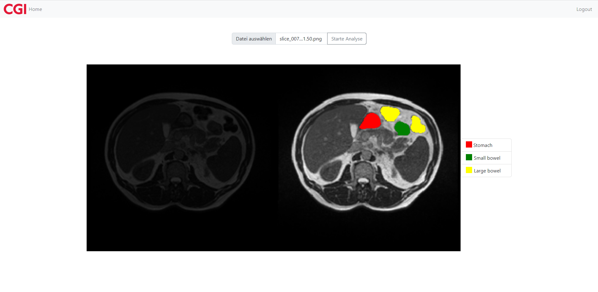 MRI Use Case screenshot