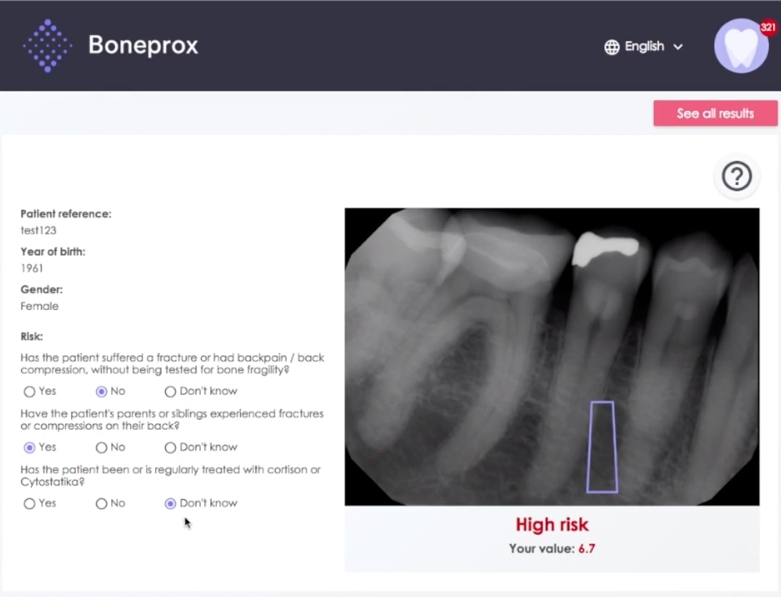 Xray Boneprox