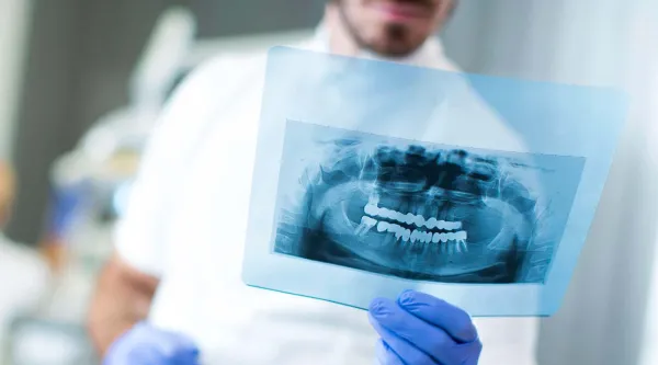 Boneprox xray jaw