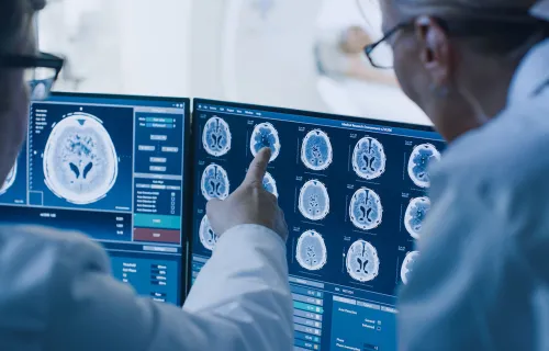 Två läkare granskar hjärnröntgenbilder på flera datorskärmar i en modern medicinsk miljö. Den…