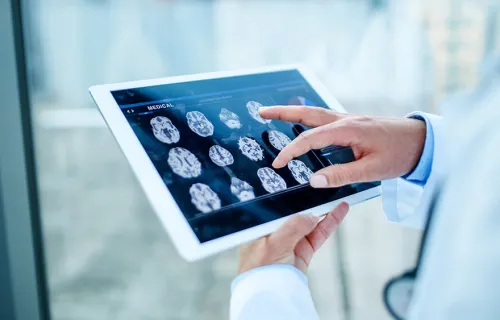 En surfplatta som visar medicinska bilder över hjärnan