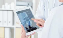 X-ray displayed on tablet