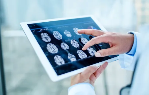 Ein Arzt schaut sich Röntgenaufnahmen auf einem Tablet an